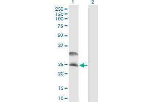 Western Blot analysis of DNAJC5 expression in transfected 293T cell line by DNAJC5 MaxPab polyclonal antibody. (DNAJC5 anticorps  (AA 1-198))