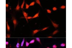 Immunofluorescence analysis of NIH/3T3 cells using METTL3 Polyclonal Antibody at dilution of 1:100 (40x lens).