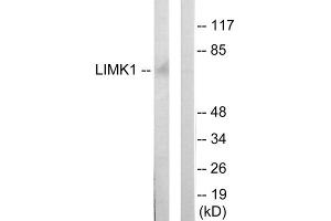 Western blot analysis of extracts from mouse brain cells, using LIMK1 antibody. (LIM Domain Kinase 1 anticorps  (Internal Region))