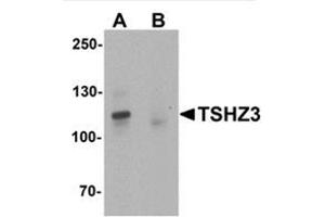 Western blot analysis of TSHZ3 in mouse brain tissue lysate with TSHZ3 / ZNF537 Antibody at 1 µg/ml in (A) the absence and (B) the presence of blocking peptide. (TSHZ3 anticorps  (N-Term))