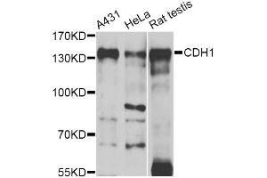 Western blot analysis of extracts of various cell lines, using CDH1 antibody (ABIN5997408) at 1/1000 dilution. (E-cadherin anticorps)