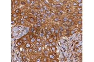 ABIN6268689 at 1/100 staining human breast tissues sections by IHC-P. (HMOX2 anticorps  (Internal Region))
