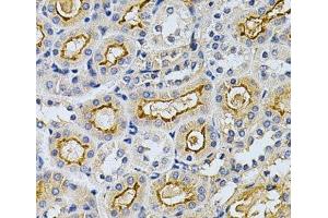 Immunohistochemistry of paraffin-embedded Mouse kidney using ADRBK1 Polyclonal Antibody at dilution of 1:200 (40x lens). (GRK2 anticorps)