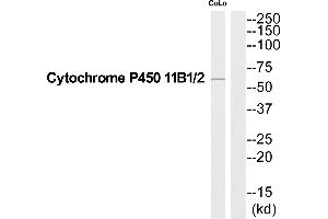 Western blot analysis of extracts from COLO205 cells, using Cytochrome P450 11B1/2 antibody. (Cytochrome P450 11B1/2 (C-Term) anticorps)