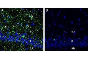 Expression of CX3CR1 in rat hippocampus - Immunohistochemical staining of perfusion-fixed frozen rat brain sections with Anti-CX3CR1 (extracellular) Antibody (ABIN7043047, ABIN7044194 and ABIN7044195), (1:300), followed by goat anti-rabbit-AlexaFluor-488. (CX3CR1 anticorps  (Extracellular, N-Term))