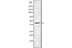Western blot analysis NR2E1 using HeLa whole cell lysates