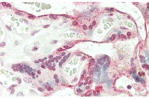 Formalin-fixed and paraffin-embedded H.