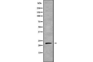 Western blot analysis NKIRAS1 using mouse liver lysates (NKIRAS1 anticorps  (C-Term))