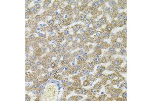 Immunohistochemistry of paraffin-embedded rat liver using CEP164 antibody. (CEP164 anticorps)