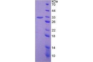 SDS-PAGE of Protein Standard from the Kit (Highly purified E. (PTGS2 Kit ELISA)