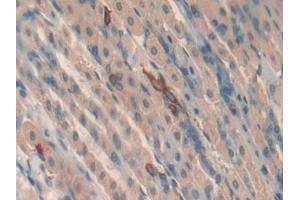 Detection of TOLLIP in Mouse Stomach Tissue using Polyclonal Antibody to Toll Interacting Protein (TOLLIP)