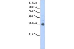 Western Blotting (WB) image for anti-Zinc Finger Protein 197 (ZNF197) antibody (ABIN2461810) (ZNF197 anticorps)