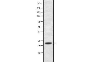 Western blot analysis of RANBP1 using MCF7 whole cell lysates
