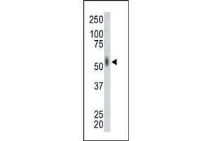 The anti-MKNK2 Pab (ABIN391072 and ABIN2841219) is used in Western blot to detect MKNK2 in mouse lung tissue lysate.