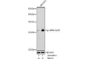 Western blot analysis of extracts of NIH/3T3 cells, using Phospho-eIF4E-S209 antibody (ABIN6135213, ABIN6136062, ABIN6136063 and ABIN6225650) at 1:500 dilution. (EIF4E anticorps  (pSer209))