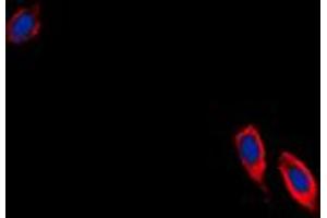 Immunofluorescent analysis of Ephrin B3 staining in NIH3T3 cells.