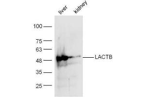 LACTB anticorps  (AA 101-200)