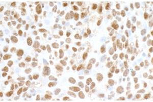 Immunohistochemistry (IHC) image for anti-Fused in Sarcoma (FUS) (AA 1-50) antibody (ABIN7454040)