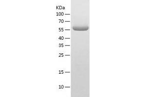 Western Blotting (WB) image for Set1/Ash2 Histone Methyltransferase Complex Subunit ASH2 (ASH2L) (AA 96-628) protein (His-IF2DI Tag) (ABIN7125072)