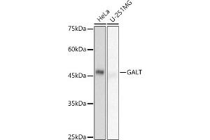 Western blot analysis of extracts of various cell lines, using GALT antibody (ABIN7267332) at 1:500 dilution. (GALT anticorps)