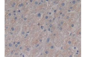 Detection of FGA in Human Liver Tissue using Polyclonal Antibody to Fibrinogen Alpha Chain (FGA)