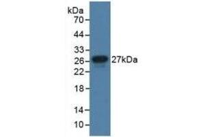 Detection of Recombinant JAM1, Human using Polyclonal Antibody to Junctional Adhesion Molecule 1 (JAM1) (F11R anticorps  (AA 64-249))