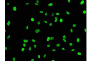 anti-Histone H3.1 (HIST1H3B) (H3K18me1) antibody