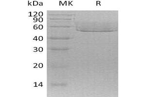 Western Blotting (WB) image for Chemokine (C-X3-C Motif) Ligand 1 (CX3CL1) protein (His tag) (ABIN7320496)