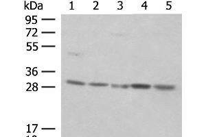 Western blot analysis of NIH/3T3 cell Mouse spleen tissue K562 cell Hela cell 231 cell lysates using PSMA4 Polyclonal Antibody at dilution of 1:400 (PSMA4 anticorps)