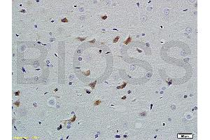 Formalin-fixed and paraffin embedded rat brain labeled with Anti PHAP1 Polyclonal Antibody, Unconjugated (ABIN762176) at 1:200 followed by conjugation to the secondary antibody and DAB staining (PHAP anticorps  (AA 41-140))