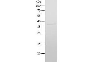 Western Blotting (WB) image for Interferon Induced Transmembrane Protein 2 (IFITM2) (AA 1-132) protein (His-IF2DI Tag) (ABIN7123491)