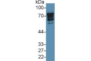 Detection of EPN1 in Human 293T cell lysate using Polyclonal Antibody to Epsin 1 (EPN1) (Epsin 1 anticorps  (AA 279-437))