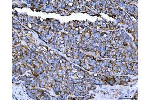 IHC analysis of TRPM4 using anti-TRPM4 antibody (ABIN3044557).