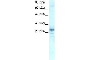 WB Suggested Anti-NKX2-8 Antibody Titration:  0.