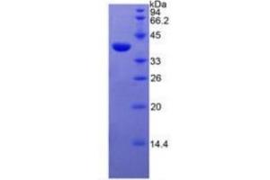 SDS-PAGE of Protein Standard from the Kit (Highly purified E. (EGFR Kit ELISA)