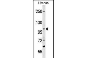 SCUBE3 Antibody (Center) (ABIN1538453 and ABIN2838104) western blot analysis in Uterus tissue lysates (35 μg/lane). (SCUBE3 anticorps  (AA 480-509))
