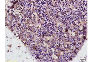 anti-Adenosine Deaminase (ADA) (AA 65-170) antibody