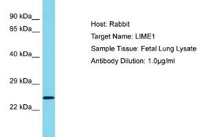 Host: Rabbit Target Name: LIME1 Sample Tissue: Human Fetal Lung Antibody Dilution: 1ug/ml (LIME anticorps  (C-Term))