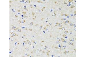 Immunohistochemistry of paraffin-embedded Rat brain using YWHAZ Polyclonal Antibody at dilution of 1:100 (40x lens). (14-3-3 zeta anticorps)