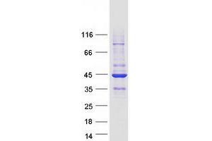 Validation with Western Blot