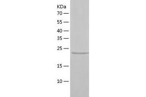 Western Blotting (WB) image for Sperm Associated Antigen 7 (SPAG7) (AA 1-227) protein (His-IF2DI Tag) (ABIN7125184)