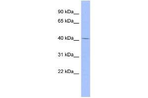 WB Suggested Anti-CFP Antibody Titration: 0. (CFP anticorps  (Middle Region))