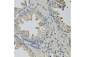 Immunohistochemistry of paraffin-embedded human prostate using LITAF Antibody.