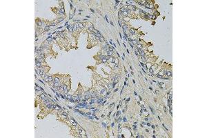 Immunohistochemistry of paraffin-embedded human prostate using LITAF Antibody. (LITAF anticorps  (AA 1-161))