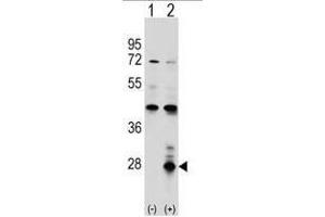 Western blot analysis of AZU1 (arrow) using rabbit polyclonal AZU1 Antibody (Center) .
