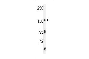 Western blot analysis of ZO1 Antibody in K562 cell line lysates (35ug/lane)