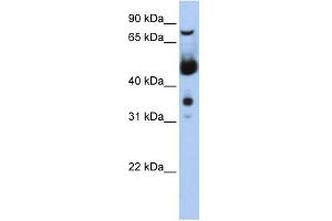 WB Suggested Anti-MNAT1 Antibody Titration:  0. (MNAT1 anticorps  (N-Term))