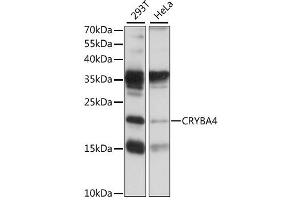 Western blot analysis of extracts of various cell lines, using CRYBA4 antibody (ABIN6292461) at 1:1000 dilution.