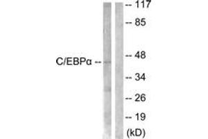 Western blot analysis of extracts from 293 cells, treated with Insulin 0. (CEBPA anticorps  (AA 6-55))