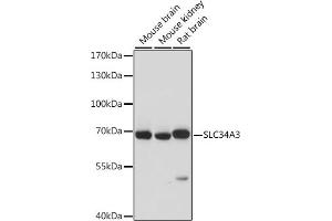 Western blot analysis of extracts of various cell lines, using SLC34 antibody (ABIN7270451) at 1:1000 dilution. (SLC34A3 anticorps  (AA 210-320))